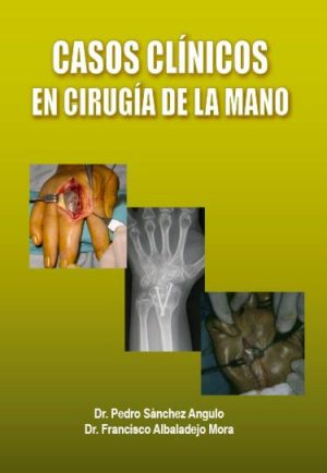 Casos Clínicos en Cirugía de la Mano -0