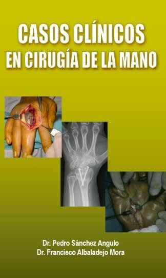 Casos Clínicos en Cirugía de la Mano -0