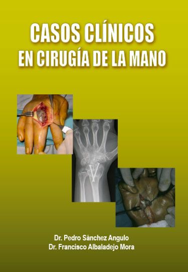 Casos Clínicos en Cirugía de la Mano -0
