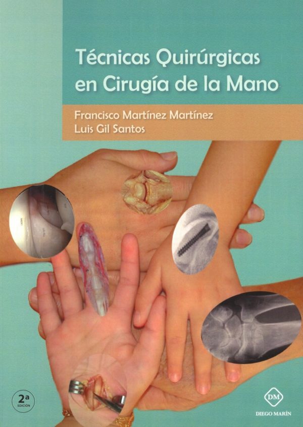 Técnicas quirúrgicas en cirugía de la mano -0