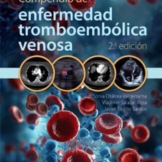 Compendio de enfermedad tromboembólica venosa