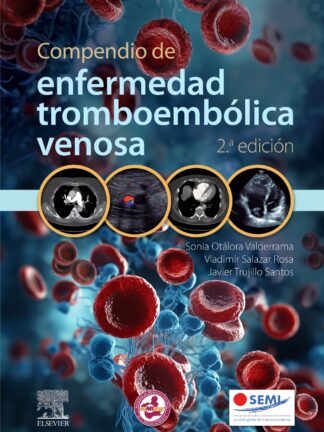 Compendio de enfermedad tromboembólica venosa