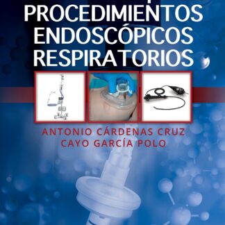 Manual de sedación para procedimientos endoscópicos respiratorios